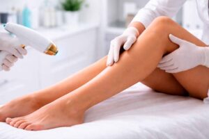 eliminar varices